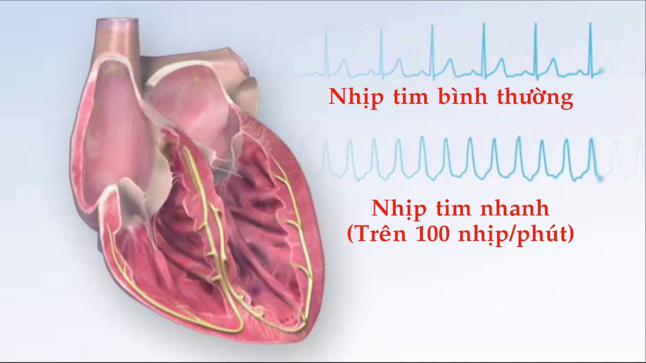 Nhịp tim bình thường là bao nhiêu? Cách chuẩn đoán bệnh từ nhịp tim