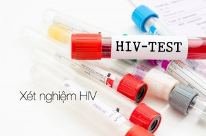 Xét nghiệm tải lượng virus HIV 